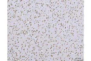 IHC analysis of AREB6/ZEB1 using anti-AREB6/ZEB1 antibody (ABIN7602990).