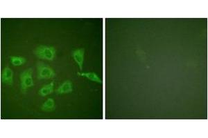Immunofluorescence analysis of HuvEc cells, using Trk A (Ab-791) Antibody. (TRKA antibody  (AA 747-796))