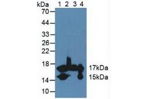 Figure. (FABP4 antibody  (AA 2-132))