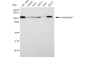 Western blotting analysis using Hexokinase 1 antibody (ABIN7798906). (Recombinant Hexokinase 1 antibody)