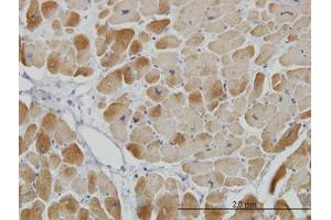Image no. 1 for anti-Acyl-CoA Dehydrogenase, Very Long Chain (ACADVL) (AA 345-435) antibody (ABIN598520) (ACADVL antibody  (AA 345-435))