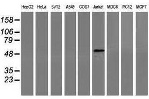 Image no. 2 for anti-Coronin, Actin Binding Protein, 1A (CORO1A) antibody (ABIN1497574) (Coronin 1a antibody)