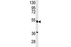 Western blot analysis of HNF4A antibody and NCI-H460 lysate. (HNF4A antibody  (AA 118-146))