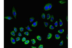 Immunofluorescent analysis of A549 cells using ABIN7161645 at dilution of 1:100 and Alexa Fluor 488-congugated AffiniPure Goat Anti-Rabbit IgG(H+L) (KLRK1 antibody  (AA 73-216))