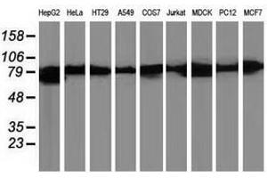 Image no. 2 for anti-Catenin (Cadherin-Associated Protein), beta 1, 88kDa (CTNNB1) antibody (ABIN1496892) (CTNNB1 antibody)