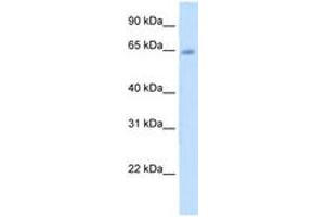 Image no. 1 for anti-Steroid Sulfatase (Microsomal), Isozyme S (STS) (AA 501-550) antibody (ABIN204976)