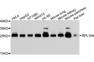 Western blot analysis of extracts of various cell lines, using RPL10A antibody (ABIN5973518) at 1/1000 dilution.
