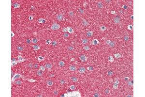 Anti-ZMYND15 antibody IHC staining of human brain, cortex. (ZMYND15 antibody  (AA 137-186))