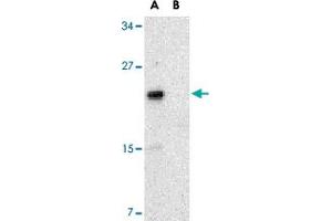 Western blot analysis of NKIRAS2 in Raw 264. (NKIRAS2 antibody  (C-Term))
