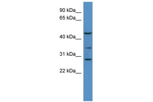 B3GALT2 antibody  (C-Term)