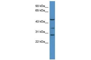 B3GALT2 antibody  (C-Term)
