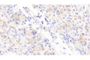 Detection of ABCD2 in Mouse Stomach Tissue using Polyclonal Antibody to ATP Binding Cassette Transporter D2 (ABCD2) (Abcd2 antibody  (AA 501-695))