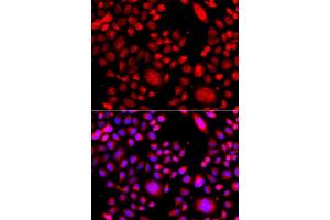 Immunofluorescence analysis of A549 cells using RAC3 antibody (ABIN5975576). (RAC3 antibody)