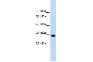 WB Suggested Anti-ADAMTS4 Antibody Titration:  0. (ADAMTS4 antibody  (N-Term))