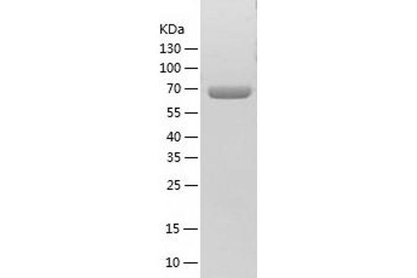 TCP1 alpha/CCTA Protein (AA 1-576) (His tag)