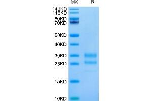 Cynomolgus IL-17A on Tris-Bis PAGE under reduced condition. (Interleukin 17a Protein (AA 24-155) (His-Avi Tag))