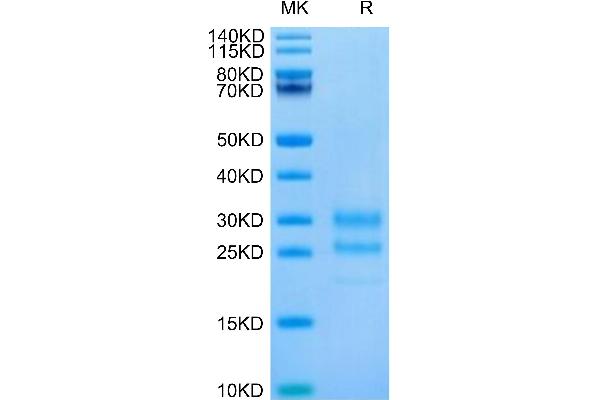 Interleukin 17a Protein (AA 24-155) (His-Avi Tag)