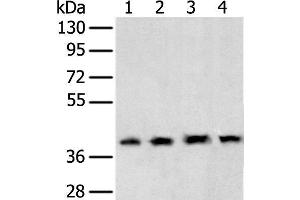 Western blot analysis of 231 cell Human testis tissue Hela and Hepg2 cell using TBP Polyclonal Antibody at dilution of 1:400 (TBP antibody)