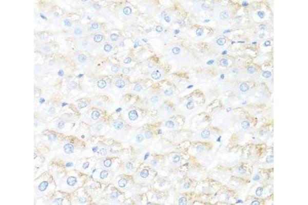 IL-7 antibody