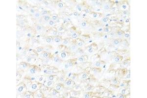 Immunohistochemistry of paraffin-embedded Rat liver using IL7 Polyclonal Antibody at dilution of 1:100 (40x lens). (IL-7 antibody)