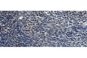 Immunohistochemistry of paraffin-embedded Human tonsil tissue using HAUS6 Polyclonal Antibody at dilution of 1:45(x200) (FAM29A antibody)
