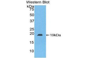 Western Blotting (WB) image for anti-Heat Shock Protein, alpha-Crystallin-Related, B6 (HSPB6) (AA 1-162) antibody (ABIN5661998) (HSPB6 antibody  (AA 1-162))