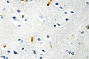 Image no. 1 for anti-TPX2, Microtubule-Associated, Homolog (Xenopus Laevis) (TPX2) antibody (ABIN317807) (TPX2 antibody)