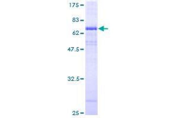 ATP6V0A2 Protein (AA 1-372) (GST tag)