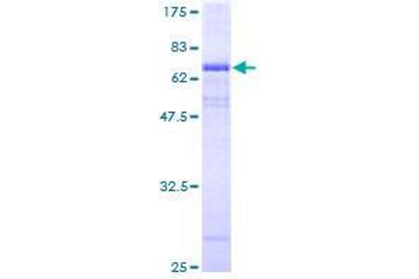 ATP6V0A2 Protein (AA 1-372) (GST tag)