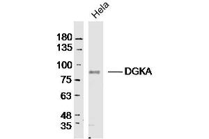 Hela lysates probed with DGKA Polyclonal Antibody, Unconjugated  at 1:300 dilution and 4˚C overnight incubation. (DGKA antibody  (AA 201-300))