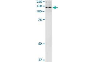 Immunoprecipitation of ADAR transfected lysate using anti-ADAR MaxPab rabbit polyclonal antibody and Protein A Magnetic Bead , and immunoblotted with ADAR purified MaxPab mouse polyclonal antibody (B01P) . (ADAR antibody  (AA 1-1226))