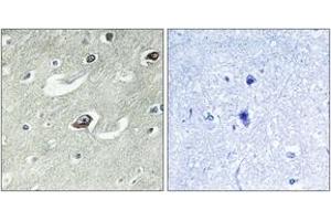 Immunohistochemistry (IHC) image for anti-Kinesin Family Member 20A (KIF20A) (AA 501-550) antibody (ABIN2888893) (KIF20A antibody  (AA 501-550))