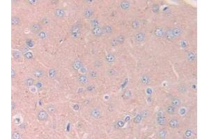 Immunohistochemistry (IHC) image for anti-Janus Kinase 2 (JAK2) (AA 916-1103) antibody (ABIN7438352)