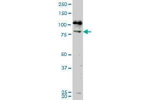 Western Blotting (WB) image for anti-NIMA-Related Kinase 5 (NEK5) (AA 601-709) antibody (ABIN961565)