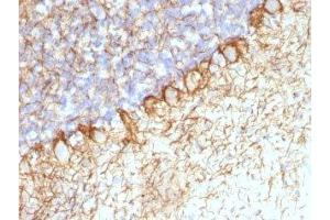 Formalin-fixed, paraffin-embedded rat cerebellum stained with Neurofilament antibody (RT-97 + NR-4). (Neurofilament antibody)