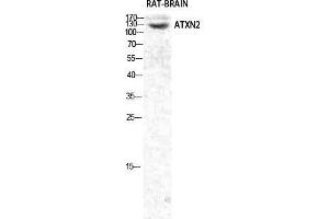 Western Blot (WB) analysis of specific cells using Ataxin-2 Polyclonal Antibody. (Ataxin 2 antibody  (Internal Region))