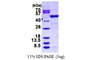 Image no. 1 for rho GDP Dissociation Inhibitor (GDI) beta (ARHGDIB) protein (GST tag) (ABIN1098209)