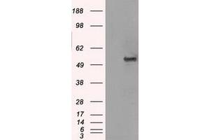 Image no. 1 for anti-Solute Carrier Family 2 (Facilitated Glucose/fructose Transporter), Member 5 (SLC2A5) antibody (ABIN1498473) (SLC2A5 antibody)
