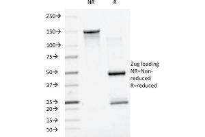 SDS-PAGE (SDS) image for anti-Small Ubiquitin Related Modifier Protein 1 (SUMO1) antibody (ABIN6940847)