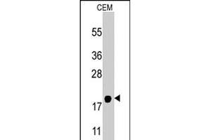 Western blot analysis of PPBP polyclonal antibody  in CEM cell line lysates (35 ug/lane). (CXCL7 antibody  (AA 99-128))