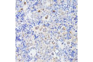 Immunohistochemistry of paraffin-embedded mouse spleen using MLF2 antibody (ABIN7268725) at dilution of 1:100 (40x lens). (MLF2 antibody  (AA 1-65))
