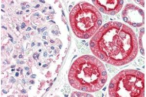 Human Kidney (formalin-fixed, paraffin-embedded) stained with ACE2 antibody ABIN461888 at 2. (ACE2 antibody  (Internal Region))