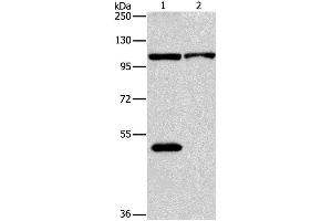 Western Blotting (WB) image for anti-NLR Family, Pyrin Domain Containing 3 (NLRP3) antibody (ABIN2427660) (NLRP3 antibody)