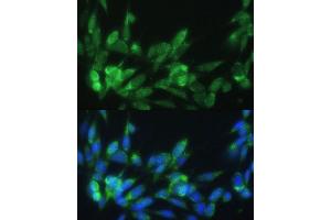 Immunofluorescence analysis of NIH-3T3 cells using LRP Polyclonal Antibody (ABIN3017160, ABIN3017161, ABIN1680715 and ABIN6219979) at dilution of 1:100 (40x lens). (LRPAP1 antibody)