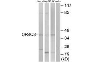 Western blot analysis of extracts from HeLa/Jurkat/HepG2 cells, using OR4Q3 Antibody. (OR4Q3 antibody  (AA 264-313))