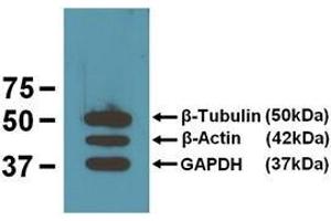 EBI’s three loading control mAbs reacting against 10μg/lane of mouse brain tissue lysates. (TUBB antibody)