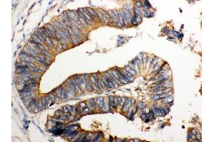 IHC(P): Human Intestinal Tissue (NMI antibody  (AA 2-307))