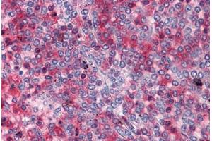 Human Spleen: Formalin-Fixed, Paraffin-Embedded (FFPE) (RRM2 antibody  (AA 1-111))