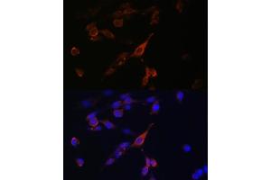 Immunofluorescence analysis of U-2 OS cells using R antibody (ABIN6128592, ABIN6146556, ABIN6146557 and ABIN6215667) at dilution of 1:100.