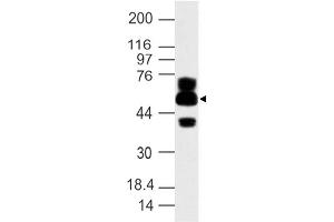 Image no. 1 for anti-ATG16 Autophagy Related 16-Like 1 (ATG16L1) (AA 35-260) antibody (ABIN5027030) (ATG16L1 antibody  (AA 35-260))